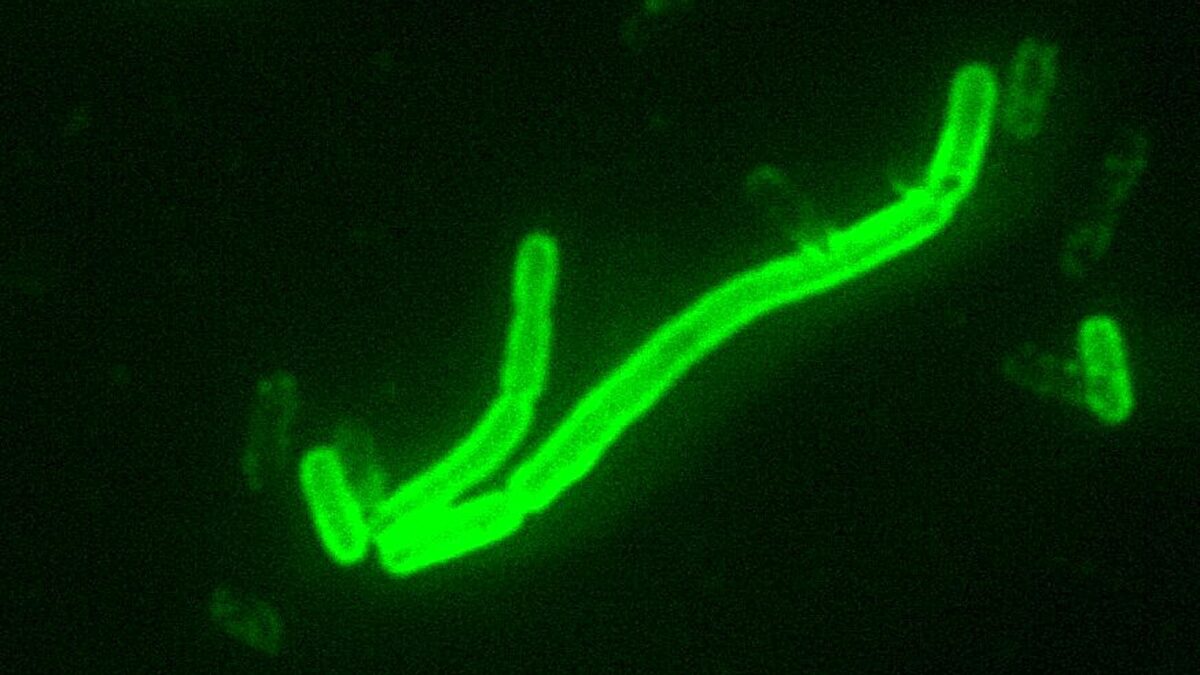 Bactérias Yersinia pestis coradas por anticorpo fluorescente direto, ampliadas 200 vezes ao microscópio
