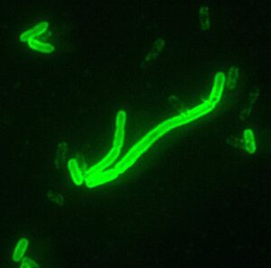 Bactérias Yersinia pestis coradas por anticorpo fluorescente direto, ampliadas 200 vezes ao microscópio