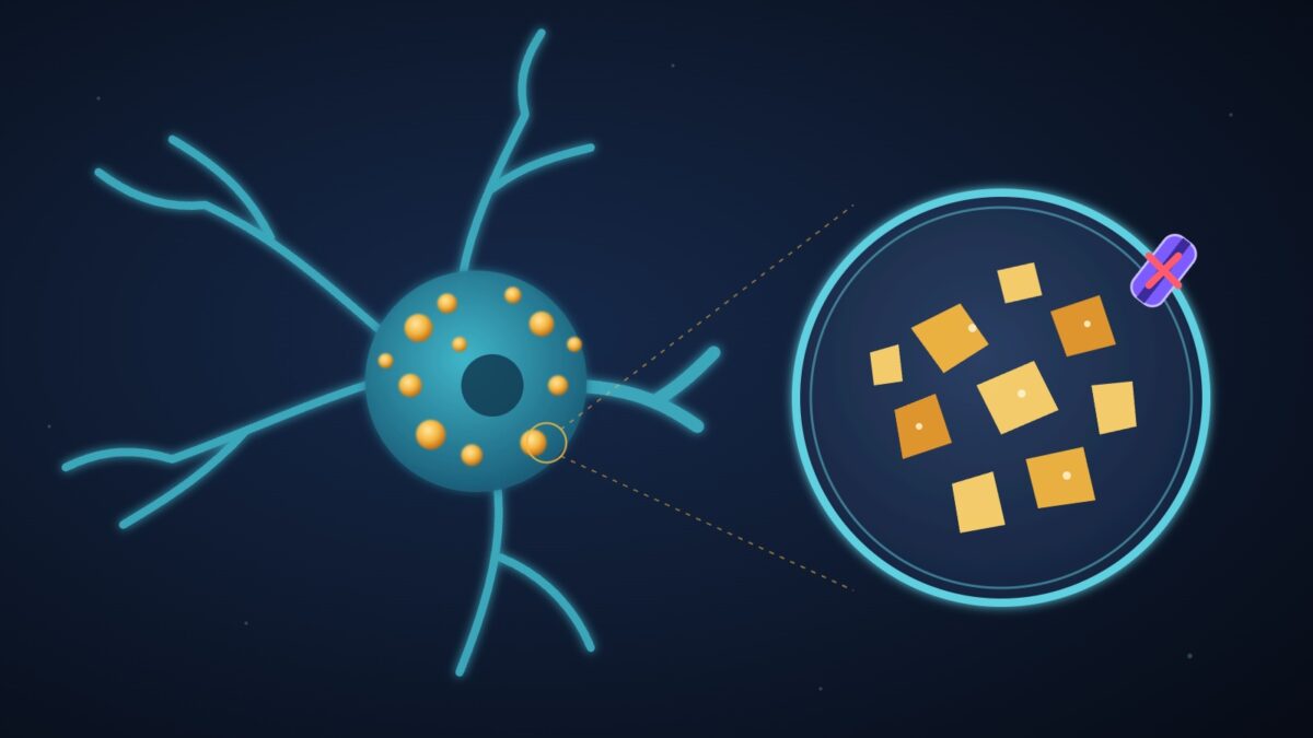 Ilustração de um neurônio com lisossomos cheios de colesterol e, em destaque, um lisossomo ampliado com o colesterol acumulado e a proteína de transporte NPC1 bloqueada