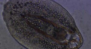 Diplostomum pseudospathaceum