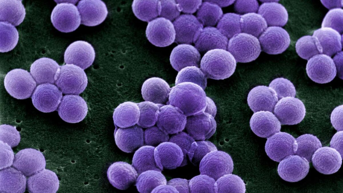 Imagem de Staphylococcus aureus vista ao microscópio, bactéria alvo do estudo em salas de velório