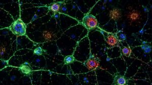 Imagem de microscopia de neurônios mostrando danos no DNA, representando o efeito do KCL-286 no Alzheimer.
