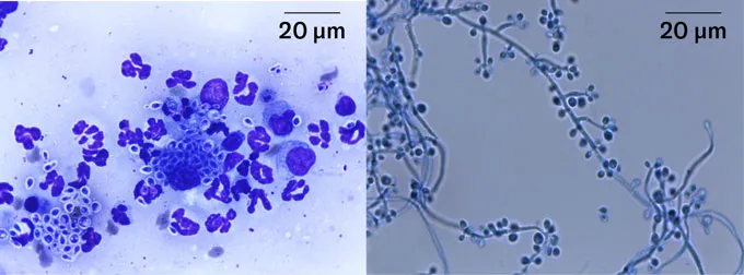 Microscopia do Sporothrix brasiliensis: forma de levedura à esquerda e forma de mofo com hifas à direita, ambas em escala de 20 micrômetros