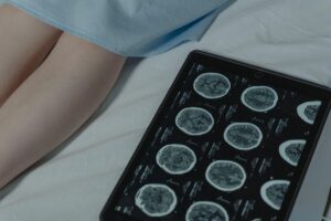 Exame de imagem cerebral do estudo sobre gene AQP4, Alzheimer e a influência do sono.