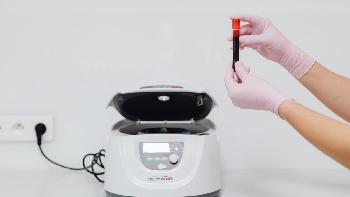 Máquina de aférese terapêutica usada para filtrar o sangue; técnica também reduz microplásticos e PFAS.
