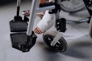 Músculo na consolidação óssea: células musculares ajudam a reparar fraturas, revela estudo.