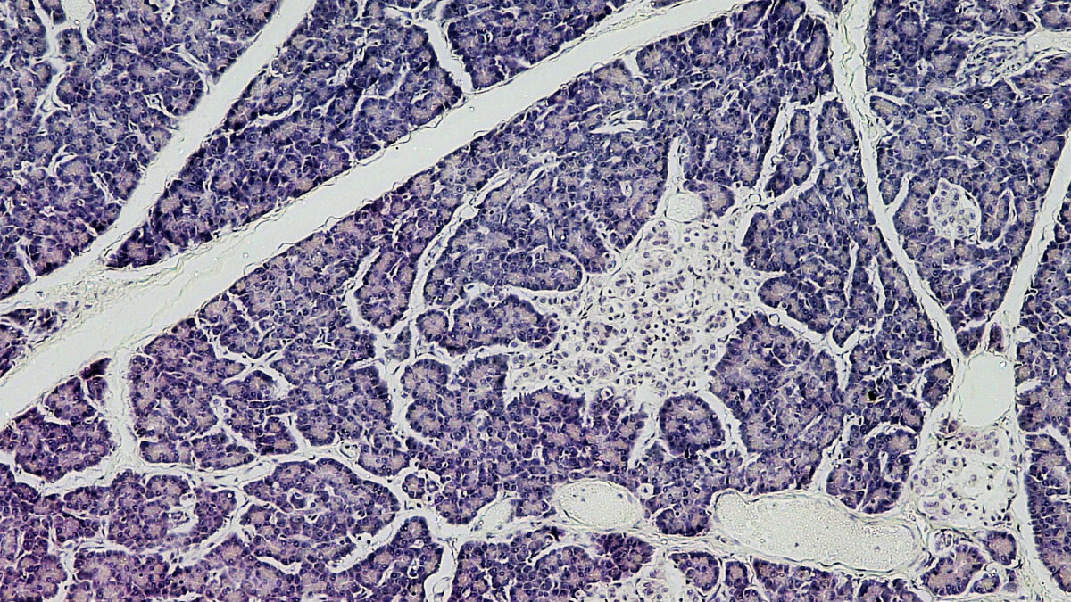 Corte de pâncreas humano ao microscópio, com uma ilhota de Langerhans, o grupo de células que produz insulina, no centro da imagem
