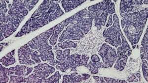 Corte de pâncreas humano ao microscópio, com uma ilhota de Langerhans, o grupo de células que produz insulina, no centro da imagem
